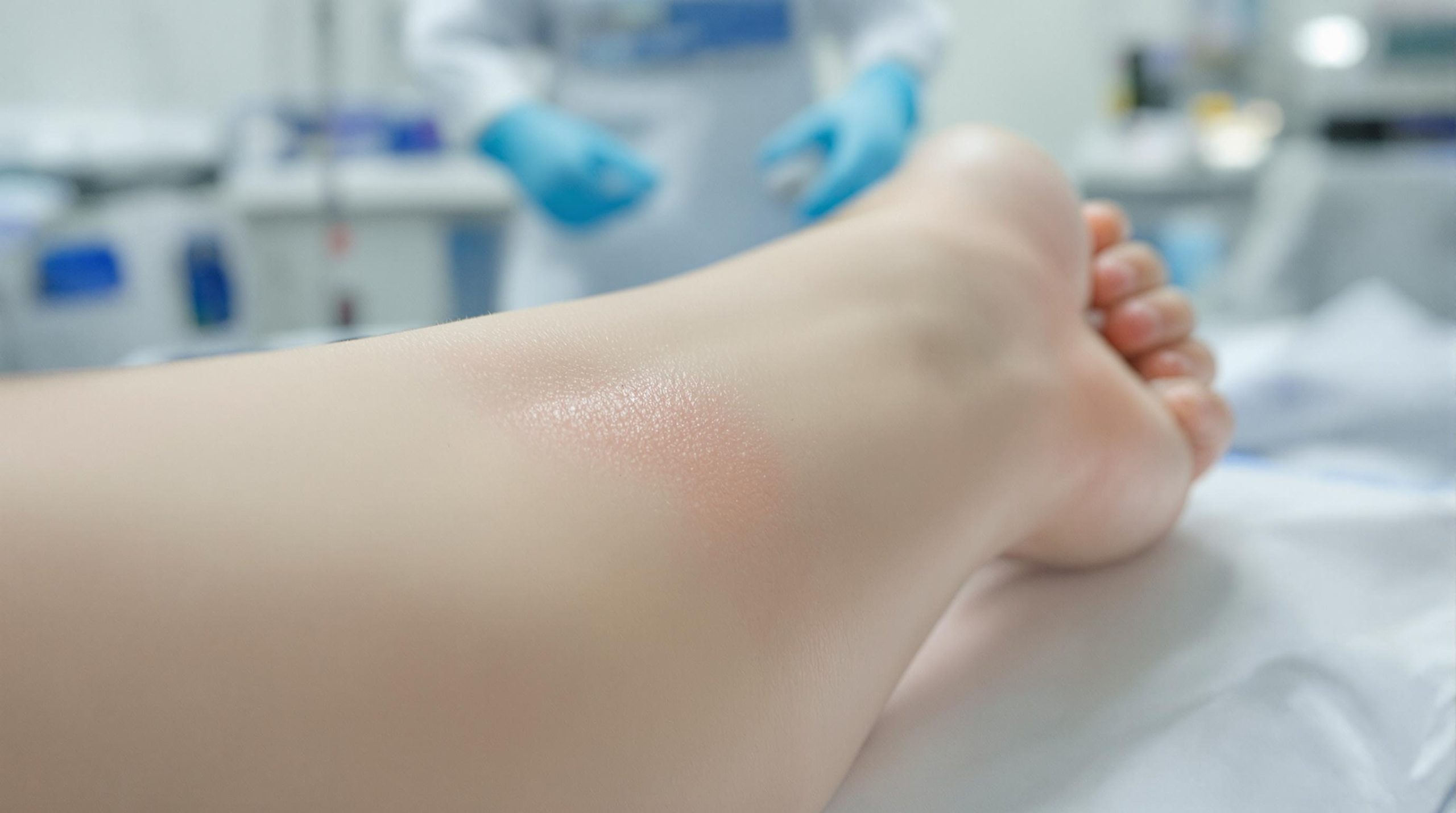 Cicatrice gonflée après opération : causes, traitements et signes à surveiller
